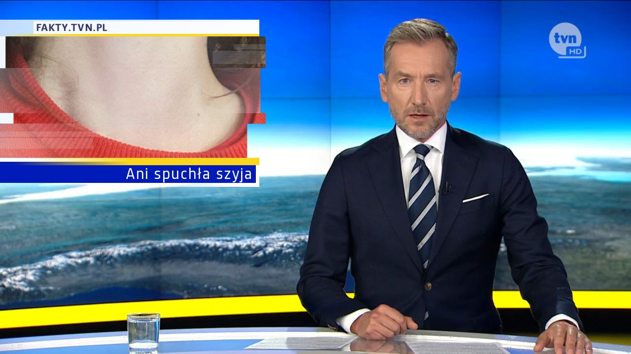 Ani spuchła szyja