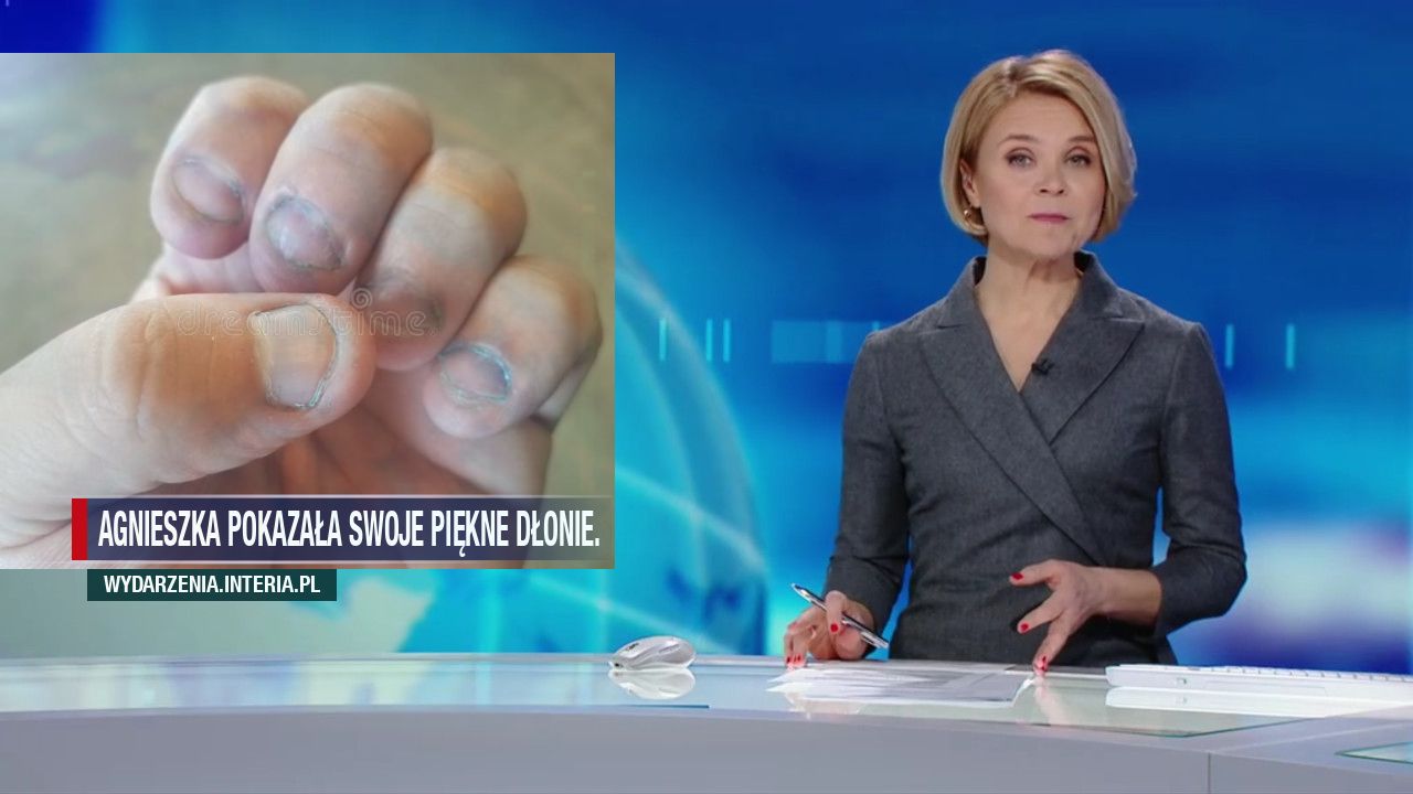 Agnieszka pokazała swoje piękne dłonie.